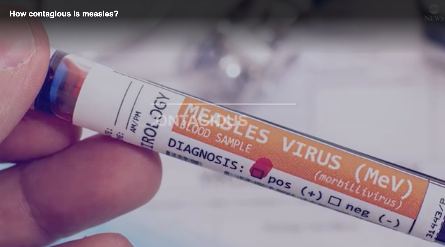 Measles case confirmed in DC, individual may have exposed others on Amtrak train